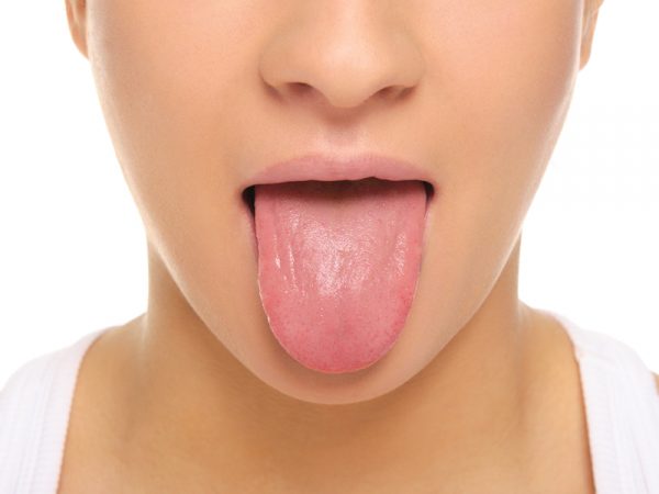 A smooth tongue, frequent ulcers and pale skin are striking signs of a Vitamin B12 deficiency. These take years to develop and sometimes hard to notice in the initial stages.